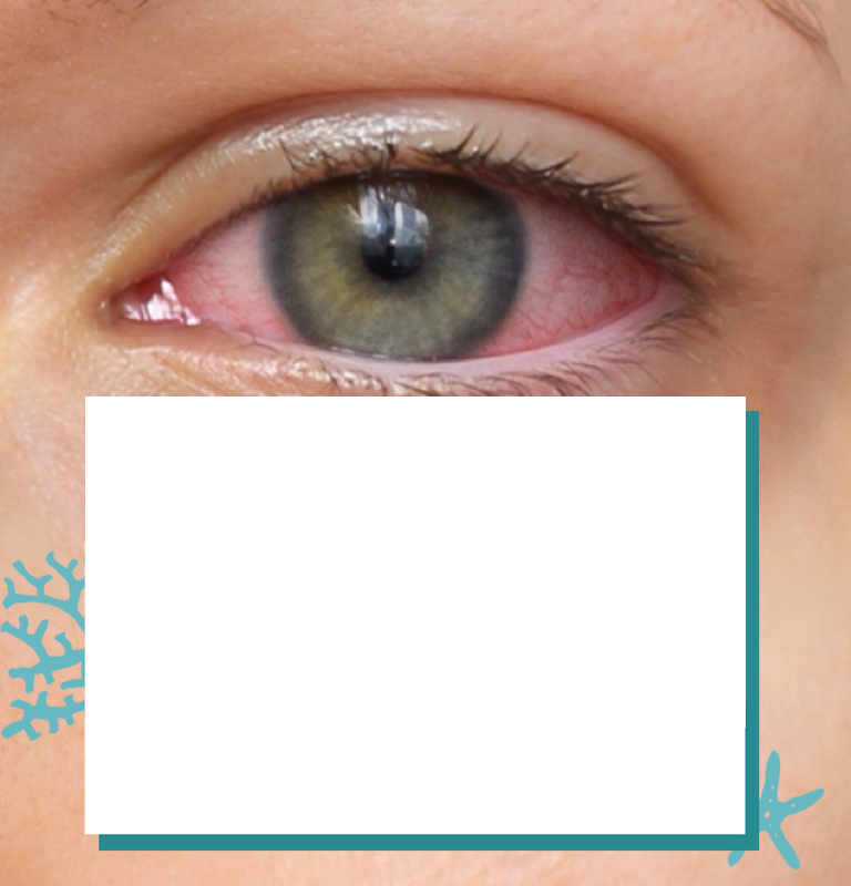 Emergency Eye Care